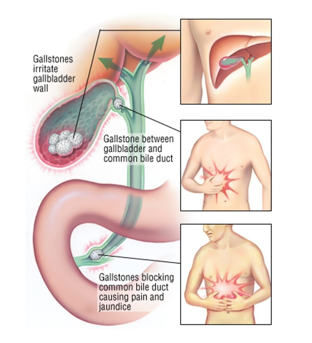 xr:d:DAGBl0o3GEs:12,j:6885301894266518978,t:24040523